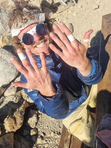 Sondres fingre, ødelagt etter Sifuentes-Monti